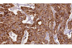anti-Myosin Phosphatase, Target Subunit 1 (PPP1R12A) (pThr696) antibody