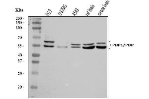 Western blot analysis of PDP1/PDP using anti-PDP1/PDP antibody (ABIN7601509).