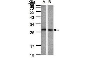 WB Image Sample(30 ug whole cell lysate) A:Hep G2 , B:Raji , 12% SDS PAGE antibody diluted at 1:1000 (LYPLA2 抗体)