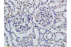 Formalin-fixed and paraffin embedded rat kidney tissue labeled with Rabbit Anti-Podoplanin/gp36 Polyclonal Antibody (ABIN736896), Unconjugated 1:200 followed by conjugation to the secondary antibody and DAB staining (Podoplanin 抗体  (AA 91-166))