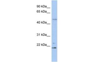 Western Blotting (WB) image for anti-Retinoblastoma Binding Protein 9 (RBBP9) antibody (ABIN2463903) (RBBP9 抗体)