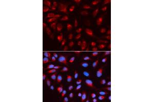 Immunofluorescence analysis of U2OS cell using CTBP1 antibody. (CTBP1 抗体  (AA 20-250))