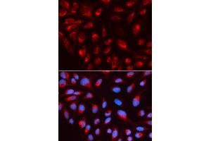 Immunofluorescence analysis of U2OS cell using CTBP1 antibody. (CTBP1 抗体  (AA 20-250))