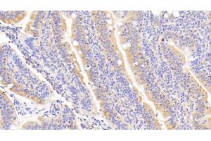 Detection of RANk in Human Small intestine Tissue using Polyclonal Antibody to Receptor Activator Of Nuclear Factor Kappa B (RANk) (TNFRSF11A 抗体  (AA 330-615))