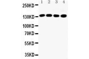 Western Blotting (WB) image for anti-Insulin Receptor Substrate 1 (IRS1) (AA 106-122), (N-Term) antibody (ABIN3042564)