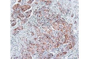 IHC analysis of COMT using anti-COMT antibody (ABIN7601948).