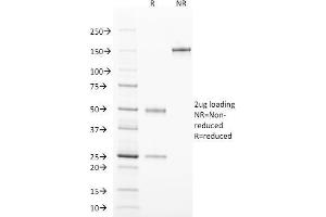 SDS-PAGE Analysis Purified TCL1 Mouse Monoclonal Antibody (TCL1/2078). (TCL1A 抗体  (AA 2-109))