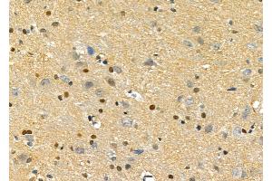 ABIN6257139 and ABIN6275758 at 1/100 staining Rat brain tissue by IHC-P.
