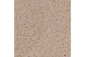 IHC analysis of Sm-D3/SNRPD3 using anti-Sm-D3/SNRPD3 antibody (ABIN7598952). (SNRPD3 抗体  (AA 1-112))