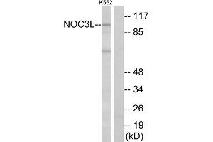 Western blot analysis of extracts from K562 cells, using NOC3L antibody. (NOC3L 抗体  (Internal Region))