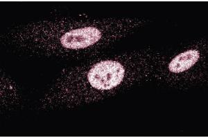 Immunofluorescence staining of human fibroblasts. (MSH3 抗体  (AA 136-349))
