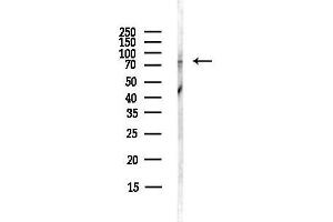 Western blot analysis of lysates from HepG2 cells(starvation,24h treatment), using R Antibody at 1/1000 dilution.