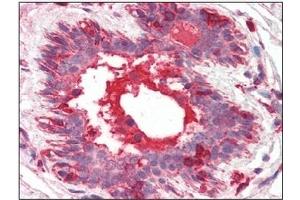 Immunohistochemistry (IHC) image for anti-Hepatocyte Growth Factor (Hepapoietin A, Scatter Factor) (HGF) antibody (ABIN492557) (HGF 抗体)