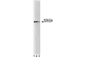 Western Blotting (WB) image for anti-Nucleoporin 62kDa (NUP62) (AA 24-178) antibody (ABIN968005) (NUP62 抗体  (AA 24-178))