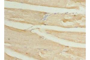 Immunohistochemistry of paraffin-embedded human skeletal muscle tissue using ABIN7175750 at dilution of 1:100 (WDR38 抗体  (AA 1-314))