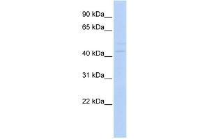 WB Suggested Anti-PAX1 Antibody Titration:  0. (PAX1 抗体  (Middle Region))