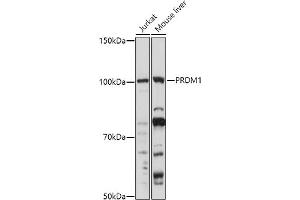 Western blot analysis of extracts of various cell lines, using (ABIN6128500, ABIN6146126, ABIN6146127 and ABIN6219111) at 1:1000 dilution. (PRDM1 抗体  (AA 1-240))