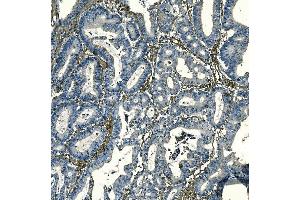 IHC analysis of F2R using anti-F2R antibody (ABIN7599952). (PAR1 抗体  (AA 130-425))