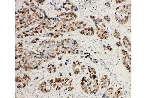 IHC-P: MCM2 antibody testing of human lung cancer tissue (MCM2 抗体  (C-Term))