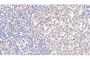 Detection of HSPA8 in Human Tonsil Tissue using Polyclonal Antibody to Heat Shock 70 kDa Protein 8 (HSPA8) (Hsc70 抗体  (AA 534-615))