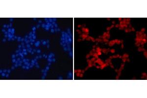 Immunofluorescence analysis of 293T cells using Asymmetric DiMethyl-Histone H4-R3 Polyclonal Antibody (Histone H4 抗体  (H4R3me2a))