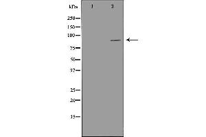 Western blot analysis of LoVo cell lysate, using PIBF1 Antibody. (PIBF1 抗体  (C-Term))