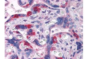 Immunohistochemical analysis of paraffin-embedded human Placenta tissues using PEG10 mouse mAb (PEG10 抗体  (AA 1-120))