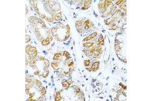 Immunohistochemistry of paraffin-embedded human stomach using INHBC antibody at dilution of 1:100 (40x lens). (INHBC 抗体)