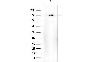 Western blot analysis of lysates from Mouse brain, using IRS1 Mouse Monoclonal Antibody at 1/1000 dilution.