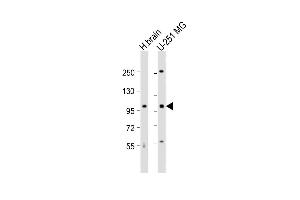 All lanes : Anti-MBD6 Antibody (C-term) at 1:1000 dilution Lane 1: human brain lysate Lane 2: U-251 MG whole cell lysate Lysates/proteins at 20 μg per lane. (MBD6 抗体  (C-Term))