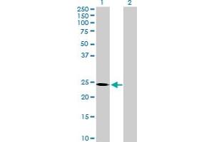 Western Blot analysis of SOHLH2 expression in transfected 293T cell line by SOHLH2 MaxPab polyclonal antibody.
