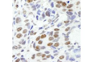 Immunohistochemistry (IHC) image for anti-Ewing Sarcoma Breakpoint Region 1 (EWSR1) (AA 100-150) antibody (ABIN7448557)