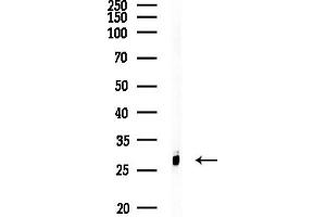 Western blot analysis of lysates from Raji cells(heat-shock,45 min treatment), using BAP31 Antibody at 1/1000 dilution.