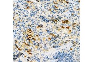 Immunohistochemistry (Paraffin-embedded Sections) (IHC (p)) image for anti-Carcinoembryonic Antigen-Related Cell Adhesion Molecule 1 (CEACAM1) antibody (ABIN7073315)