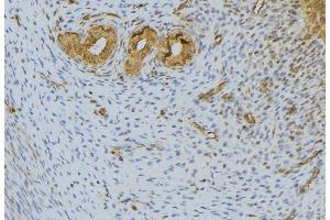 ABIN6276601 at 1/100 staining Human uterus tissue by IHC-P. (FGF10 抗体  (C-Term))
