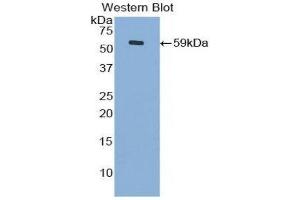 Western Blotting (WB) image for anti-Cadherin 4 (CDH4) (AA 667-916) antibody (ABIN1860421) (Cadherin 4 抗体  (AA 667-916))
