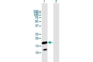 Western Blot analysis of VNN3 expression in transfected 293T cell line by VNN3 MaxPab polyclonal antibody. (VNN3 抗体  (AA 1-147))