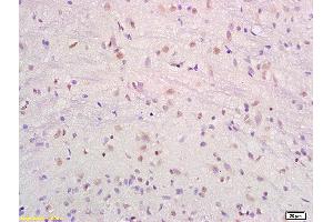 Formalin-fixed and paraffin embedded rat brain labeled with Anti-SRF/SAP2/MCM1 Polyclonal Antibody, Unconjugated (ABIN686017) at 1:200 followed by conjugation to the secondary antibody and DAB staining. (SRF 抗体  (AA 101-250))