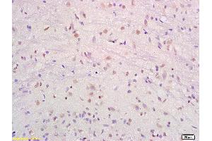Formalin-fixed and paraffin embedded rat brain labeled with Anti-SRF/SAP2/MCM1 Polyclonal Antibody, Unconjugated (ABIN686017) at 1:200 followed by conjugation to the secondary antibody and DAB staining. (SRF 抗体  (AA 101-250))