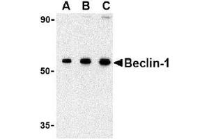 AP20054PU-N Beclin-1 antibody staining of 293 cell lysate by Western Blotting at (A) 0. (Beclin 1 抗体  (N-Term))