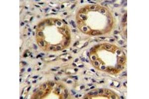 CXCR3 antibody immunohistochemistry analysis in formalin fixed and paraffin embedded human kidney tissue. (CXCR3 抗体  (AA 140-167))