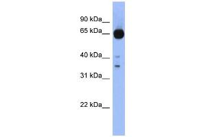 WB Suggested Anti-ZIC4 Antibody Titration:  0. (ZIC4 抗体  (Middle Region))