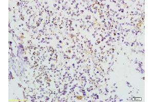 Formalin-fixed and paraffin embedded mouse lymphoma tissue labeled with Anti-TRAF3/CD40bp Polyclonal Antibody, Unconjugated  at 1:200 followed by conjugation to the secondary antibody and DAB staining (TRAF3 抗体  (AA 101-200))