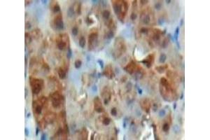 Used in DAB staining on fromalin fixed paraffin-embedded Kidney tissue (HIF1A 抗体  (AA 575-826))