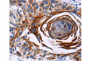 Immunohistochemistry (IHC) image for anti-Interleukin 18 Receptor 1 (IL18R1) (AA 19-320) antibody (ABIN3023691) (IL18R1 抗体  (AA 19-320))