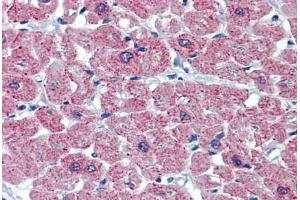 Human Heart: Formalin-Fixed, Paraffin-Embedded (FFPE) (CASQ2 抗体  (AA 20-400))