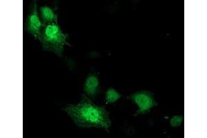 Immunofluorescence (IF) image for anti-Cyclin-Dependent Kinase 2 (CDK2) antibody (ABIN1497394) (CDK2 抗体)