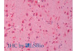 ABIN1590089 (5µg/ml) staining of paraffin embedded Human Cortex. (DVL1 抗体  (Internal Region))