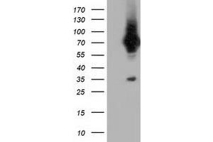 Western Blotting (WB) image for anti-Von Willebrand Factor A Domain Containing 5A (VWA5A) antibody (ABIN1501748) (VWA5A 抗体)