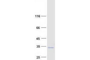 Western Blotting (WB) image for Leucine Rich Repeat Containing 61 (LRRC61) (Transcript Variant 2) protein (Myc-DYKDDDDK Tag) (ABIN2724944)
